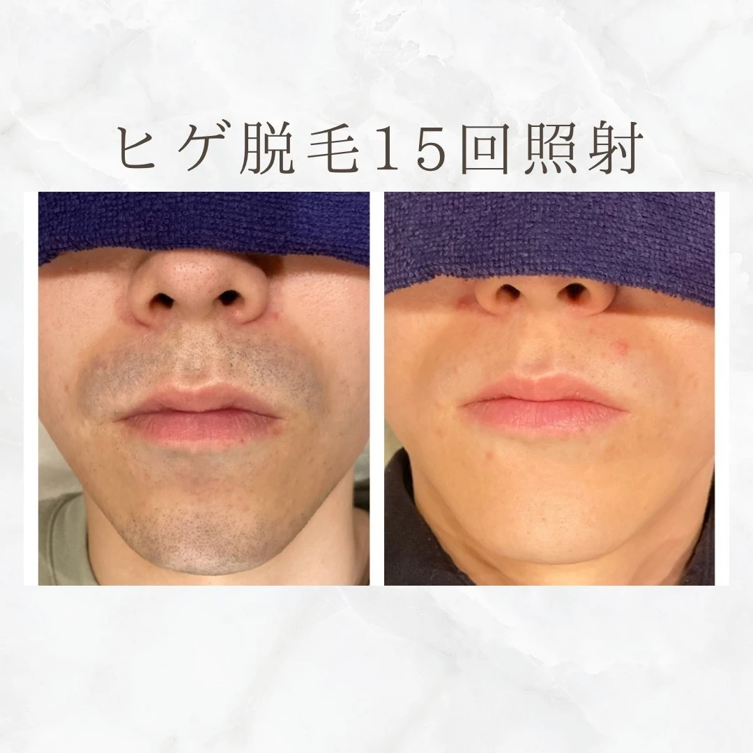 画像8438：BEFORE AFTER