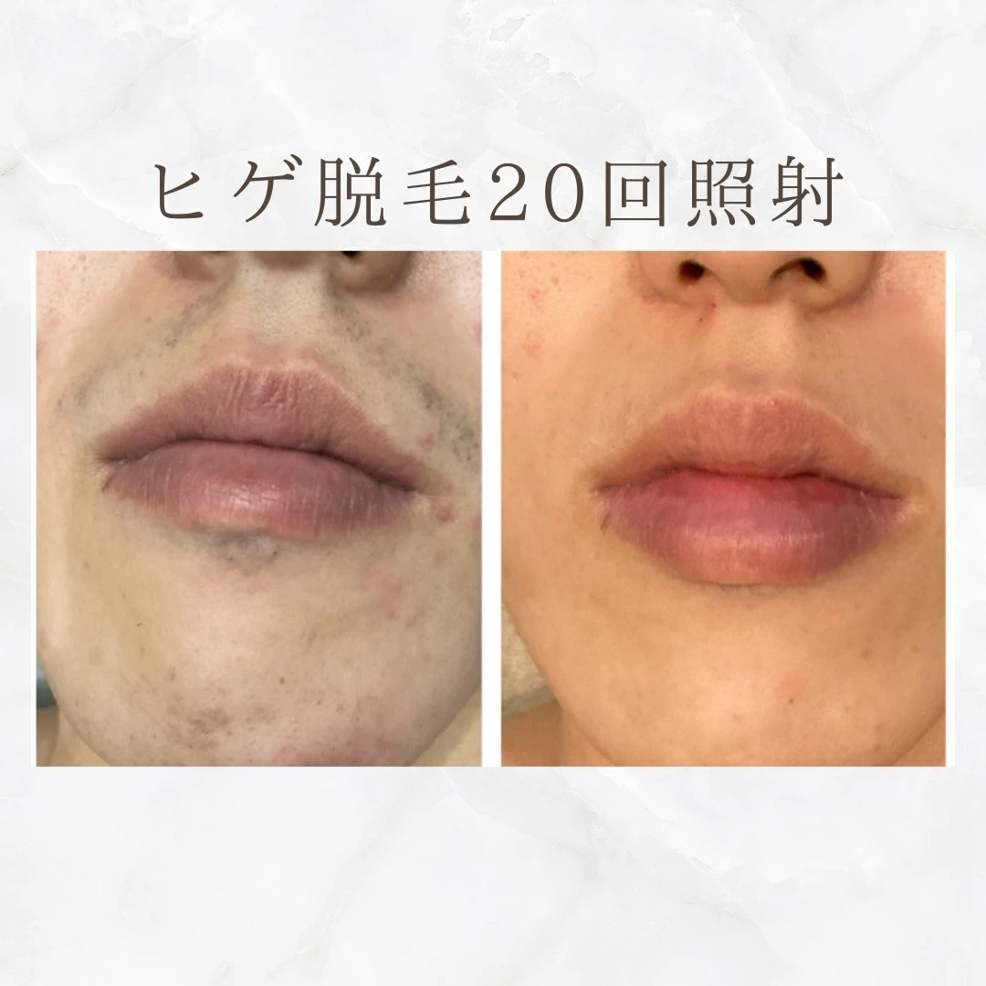 画像8440：BEFORE AFTER
