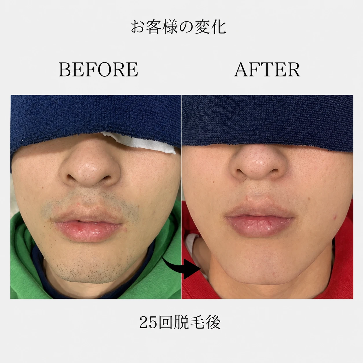 画像8857：BEFORE AFTER