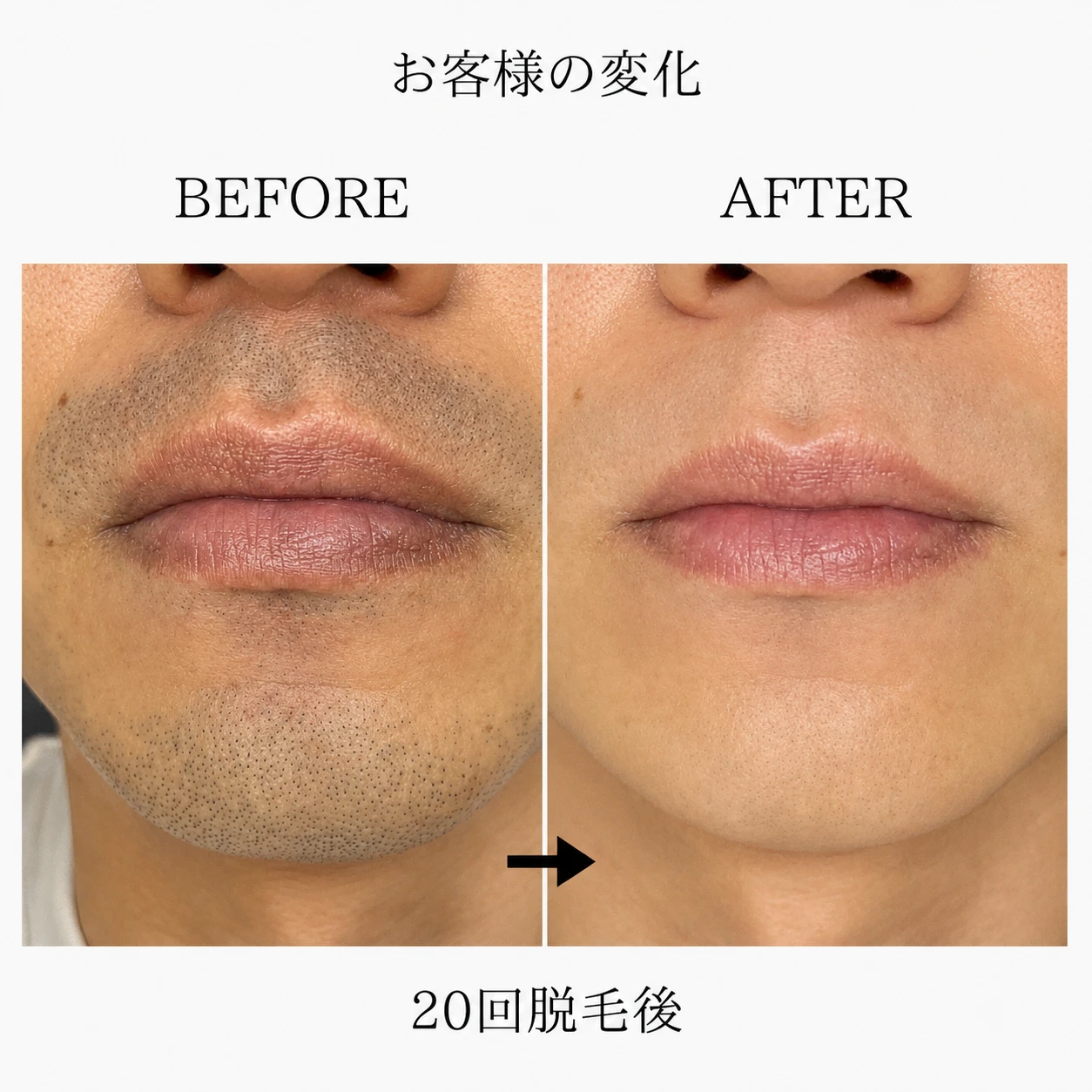 画像8858：BEFORE AFTER