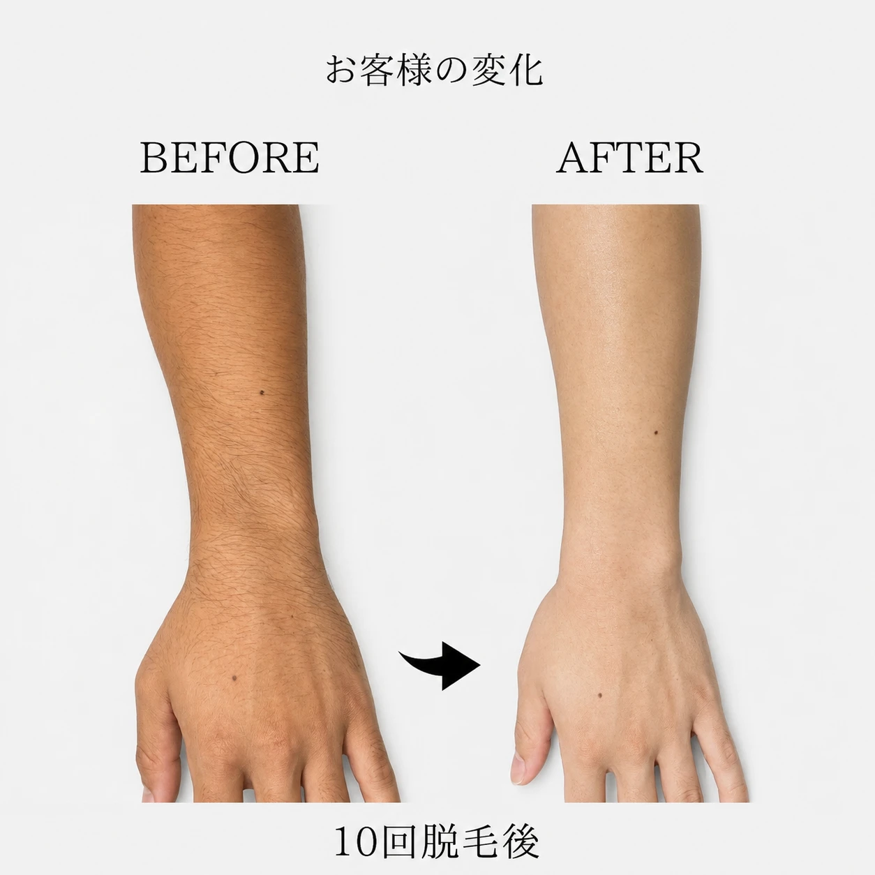 画像8859：BEFORE AFTER