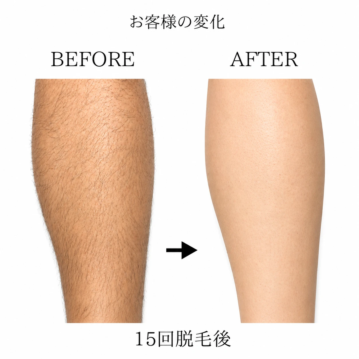 画像8860：BEFORE AFTER