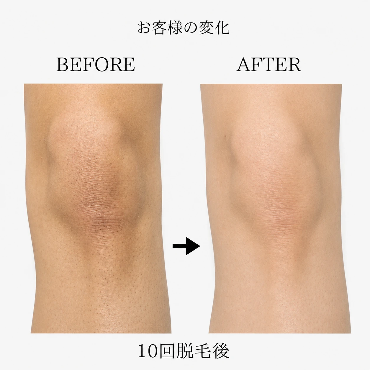 画像8861：BEFORE AFTER